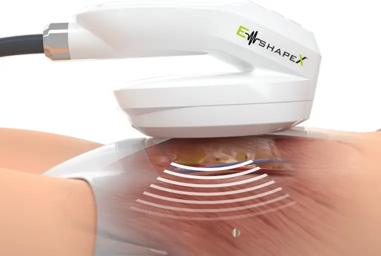 EMShape.