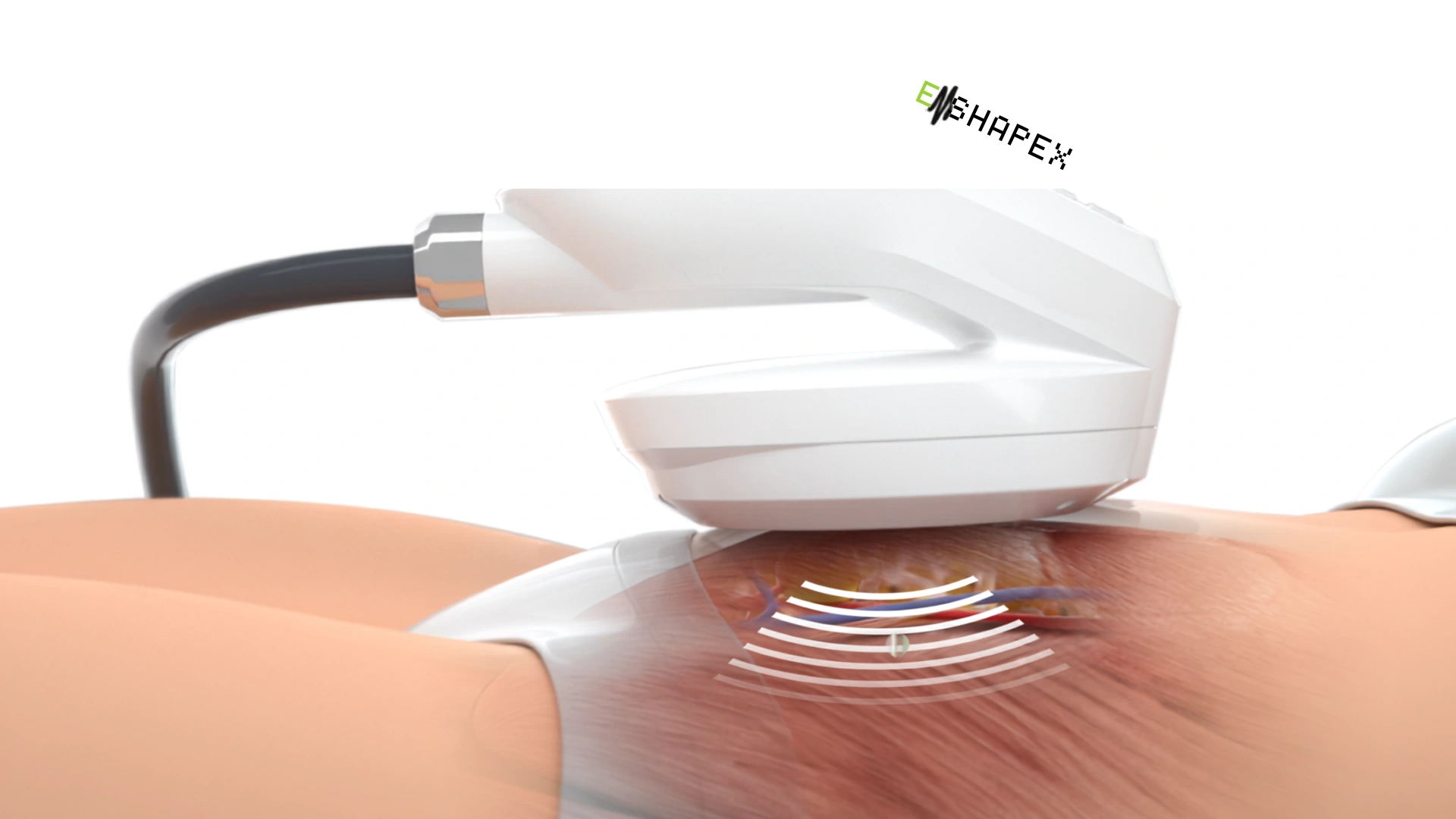 EMShapeX